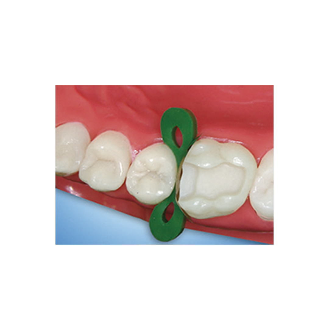 Cuñas desechables interproximales de plástico dental 100pcs (azul)
