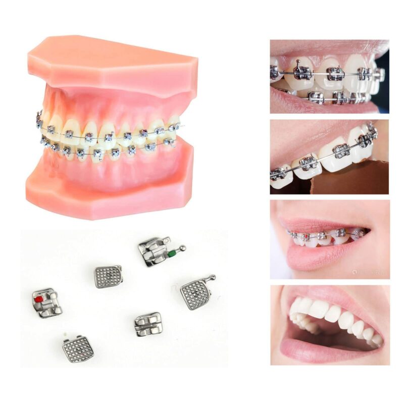 Brackets Roth. mini - Imagen 2